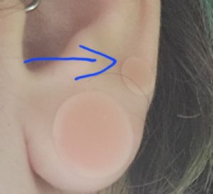 Silicone Hider Plug Customer Photo